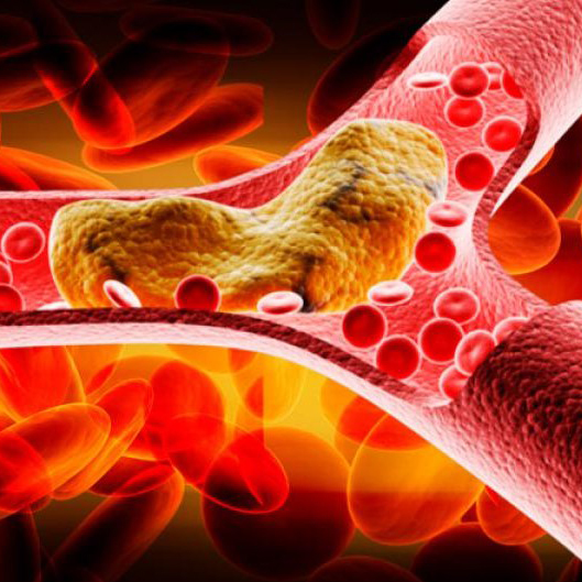 illustration of blood platelets moving around a blockage in veins